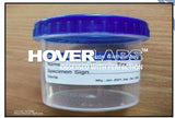 Urine Container (Model No. HVO-CONT-156)
