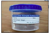 Urine Container (Model No. HVO-CONT-156)